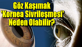 Göz Kaşımak 'Kornea Sivrileşmesi' Neden Olabilir?