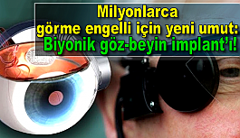 Milyonlarca görme engelli için yeni umut: Biyonik göz-beyin implant’ı!