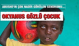 Dünya onu Okyanus gözlü çocuk haberleri ile tanıdı.