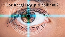 Göz Rengi Değiştirme Operasyonları Hakkında Bilinmesi Gerekenler