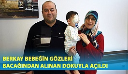 Berkay Bebeğin Gözleri Bacağından Alınan Dokuyla Açıldı