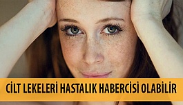 Cilt Lekeleri Hastalık Habercisi Olabilir