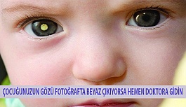 Çocuğunuzun Gözü Fotoğrafta Beyaz Çıkıyorsa Hemen Doktora Gidin