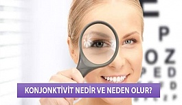 Konjonktivit Nedir ve Neden Olur?