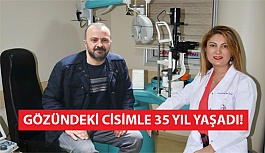 Gözündeki Cisimle 35 Yıl Yaşadı!