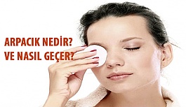 Arpacık Nedir? Arpacık Neden Olur ve Nasıl Geçer?