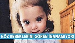 Göz Bebeklerini Gören İnanamıyor!