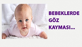 Bebeklerde Göz Kayması…