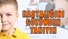 Çocuklarda Göz Muayenesi Çeşitli Hastalıkları Teşhisde Önemli