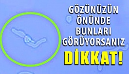 Gözde Sinek Uçuşmaları Varsa Göz Hekimine Başvurun