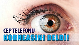 Telefon Ekranına Bakmaktan Korneası Delindi!