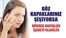 Göz Kapağı Şişliği Böbrek Hastalığı İşareti Olabilir!