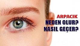 Arpacık Nedir, Neden Olur, Nasıl Geçer?