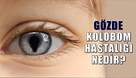 Gözde Kolobom Hastalığı Nedir?