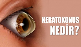 Keratokonus Nedir?