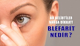 Blefarit Nedir? Nasıl Tedavi Edilir?