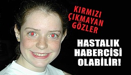 Fotoğraflarda Kırmızı Çıkmayan Gözler Hastalık Habercisi Olabilir!