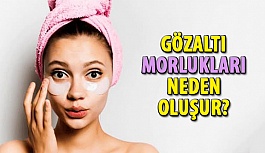 Gözaltı Morlukları Neden Olur?