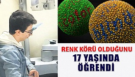 Renk Körü Olduğunu 17 Yaşında Öğrendi