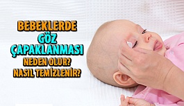 Bebeklerde Göz Bakımı