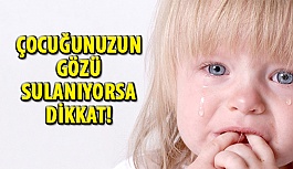 Çocuğunuzun Gözü Sulanıyorsa Dikkat!