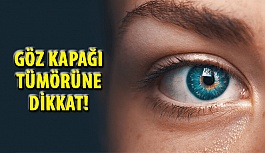 Göz Kapağı Tümörüne Dikkat!