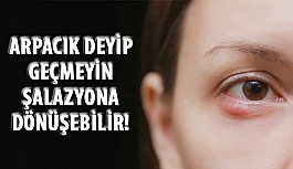 Arpacık Deyip Geçmeyin Şalazyona Dönüşebilir!