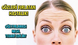 Göz Fırlaması Nasıl Tedavi Edilir?