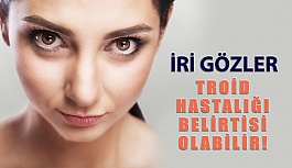 Troid Hastalığı İri Gözler İle Belirti Verebilir