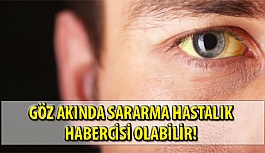 Göz Akında Sararma Hastalık Habercisi Olabilir!