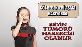 Çocuklarda Göz Bebeklerinin Aşağıya Bakması Beyin Tümörü Belirtisi Olabilir