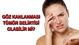 Göz Kanlanması Göz Tümörü Belirtisi Olabilir Mi?