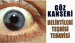 Göz Melanom Belirtileri Nedir, Nasıl Tedavi Edilir?