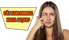 Göz Kanlanması Neden Olur? Nasıl Geçer?