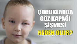 Çocuklarda Göz Kapağı Şişmesi Neden Olur?