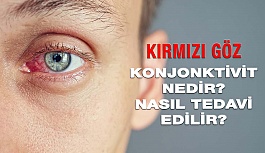 Kırmızı Göz Hastalığı Konjonktivit Nedir, Nasıl Tedavi Edilir?