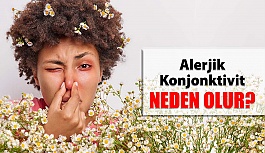 Alerjik Konjonktivit (Alerjik Pembe Göz) Nedir?