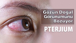 Gözün Doğal Görünümünü Bozan Hastalık: Pterjium