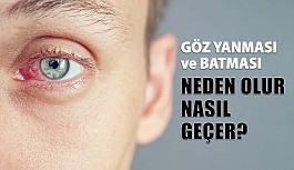 Göz Batması ve Yanması Neden Olur Nasıl Geçer?