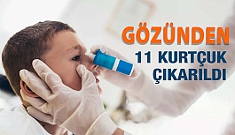 Gözünden 11 Tane Kurtçuk Çıkarıldı