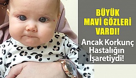 Bebeğin Büyük Mavi Gözleri Vardı Ama Korkunç Hastalığın İşaretiydi