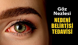 Göz Nezlesi Nedir? Nedenleri, Belirtisi ve Tedavisi