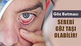 Gözünüzde Batma Varsa Sebebi Göz Taşı Olabilir