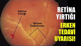 Retina Yırtığında Erken Tedavi Uyarısı