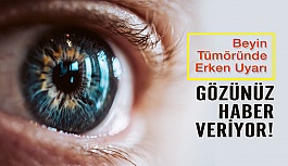 Gözleriniz Beyin Tümörü Habercisi Olabilir!