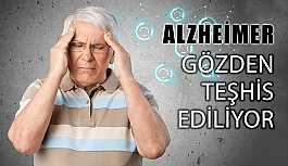 Alzheimer Gözden Erken Teşhis Edilebiliyor