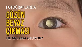 Fotoğraflarda Gözün Beyaz Çıkması Tehlikeli mi?