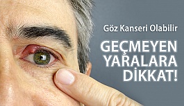 Göz Kapaklarındaki Geçmeyen Yaralara Dikkat, Göz Kanseri Olabilir