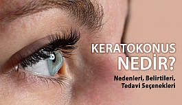 Keratokonus Nedir? Nedenleri, Belirtileri, Tedavi Seçenekleri