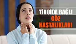 Tiroide Bağlı Göz Hastalıkları